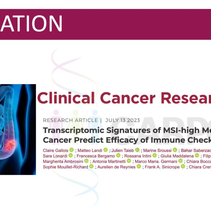 Les signatures transcriptomiques du cancer colorectal métastatique MSI-high prédisent l’efficacité de l’immunothérapies