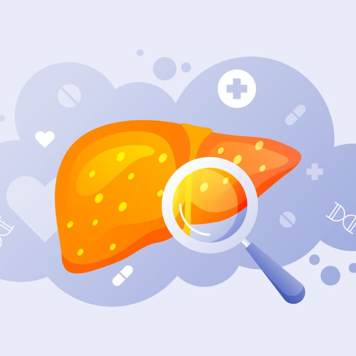 Cancer du foie : l’IA pour prédire la réponse aux traitements